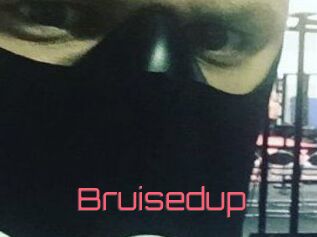 Bruisedup